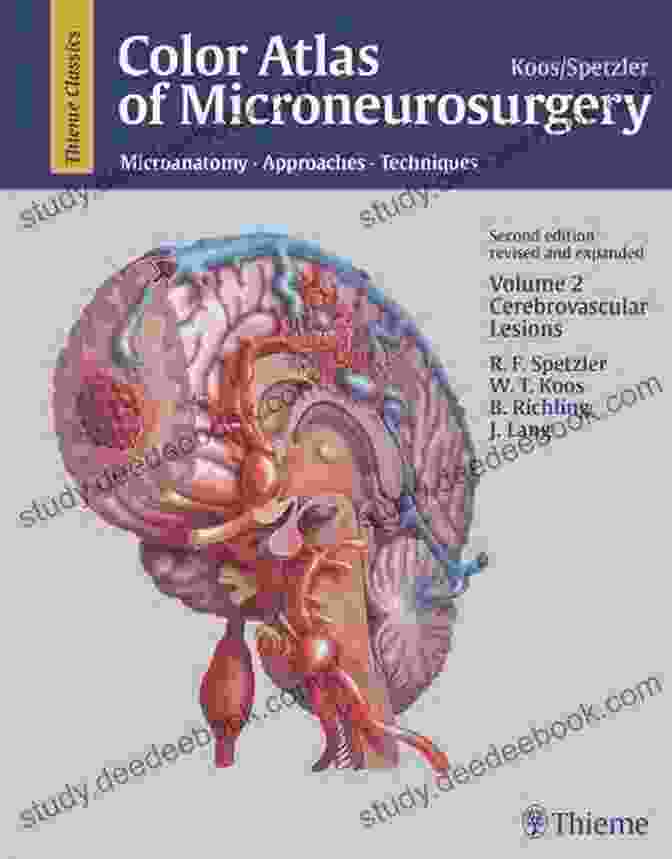 Confocal Microscopy Color Atlas Of Microneurosurgery Volume 2: Cerebrovascular Lesions: Microanatomy Approaches And Techniques