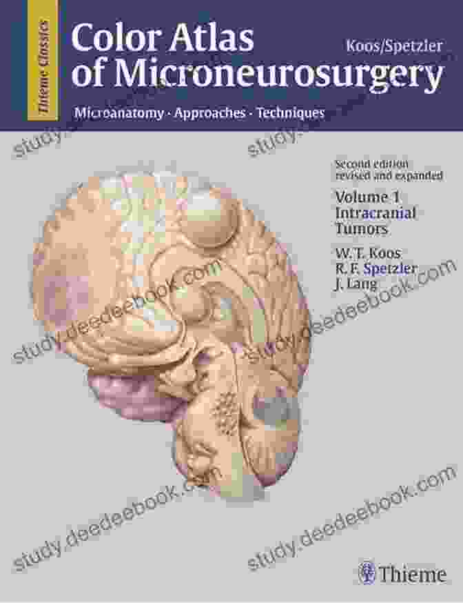 Fluorescence Microscopy Color Atlas Of Microneurosurgery Volume 2: Cerebrovascular Lesions: Microanatomy Approaches And Techniques