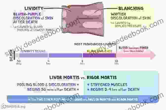 Image Of Livor Mortis, Algor Mortis, And Rigor Mortis Forensic Medicine And Toxicology Mcqs: Neet Pg Mcqs