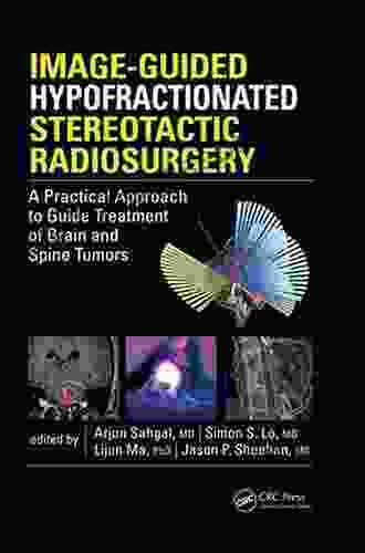 Image Guided Hypofractionated Stereotactic Radiosurgery: A Practical Approach To Guide Treatment Of Brain And Spine Tumors
