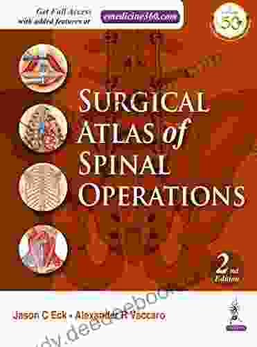 Surgical Atlas Of Spinal Operations